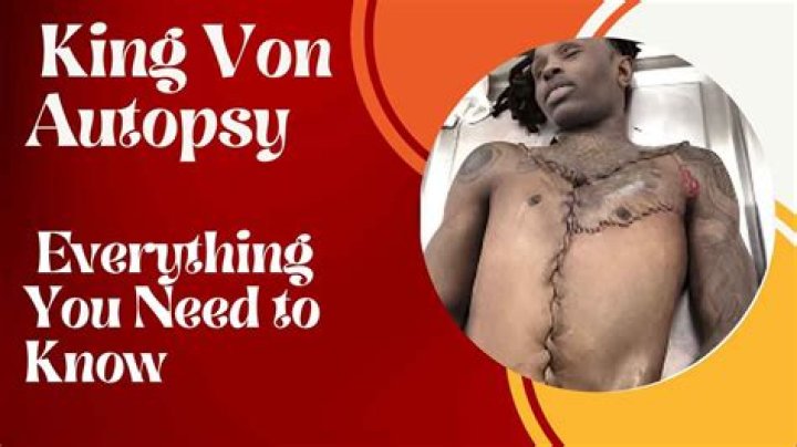 Revealed: The Startling Autopsy Findings Of King Von