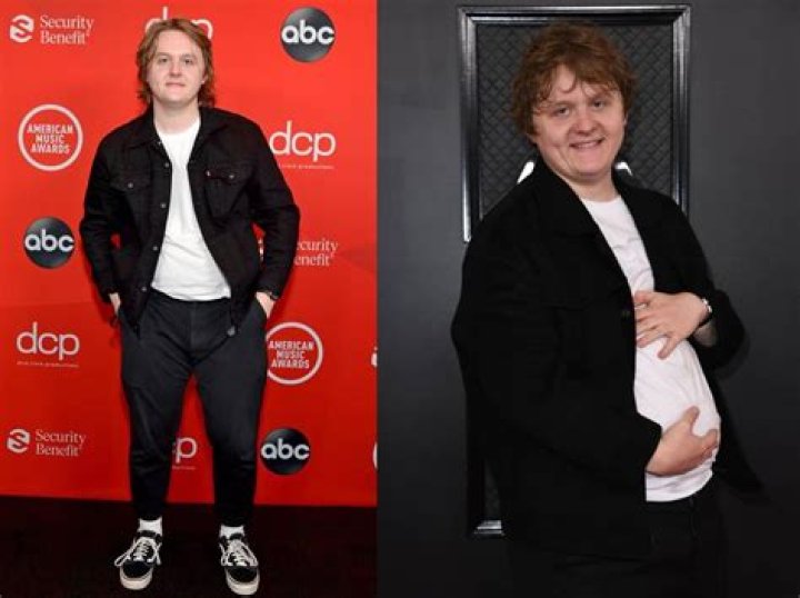 Incredible Transformation: Lewis Capaldi's Weight Loss Journey