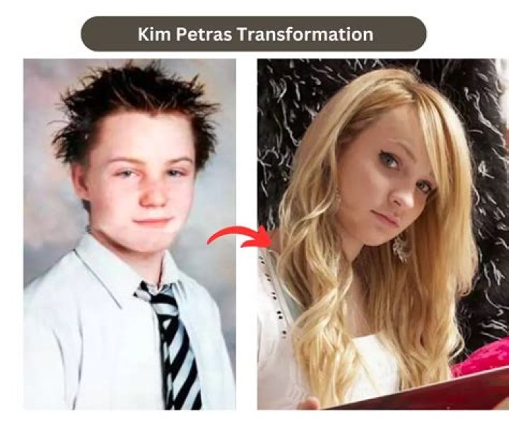 How Old Was Kim Petras When She Underwent Gender Transition?